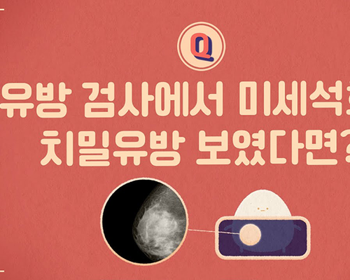 유방 검사에서 미세석회 치밀유방 보였다면? [암에 대한 바른 정보_유방암]